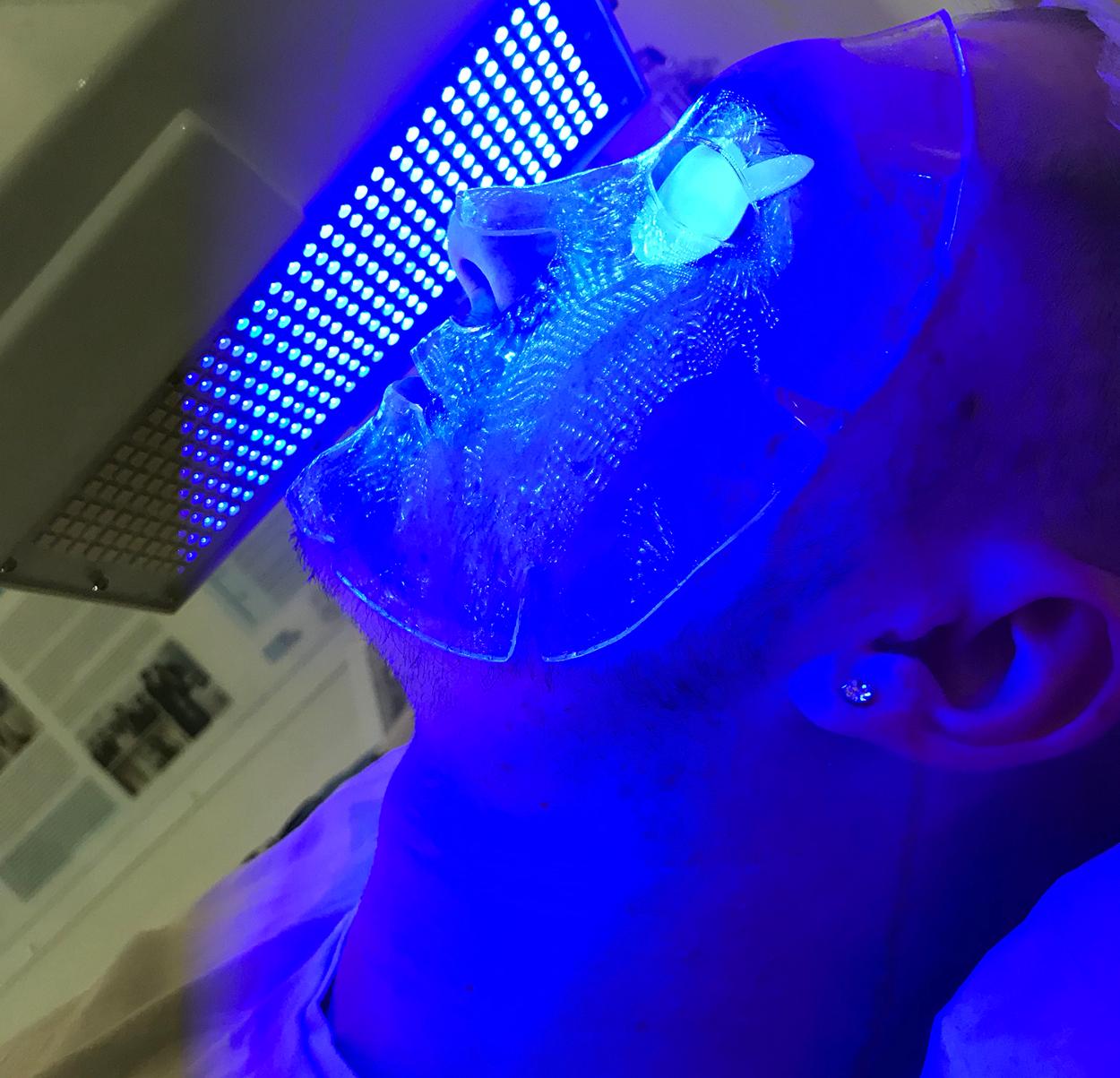blue light therapy treatment